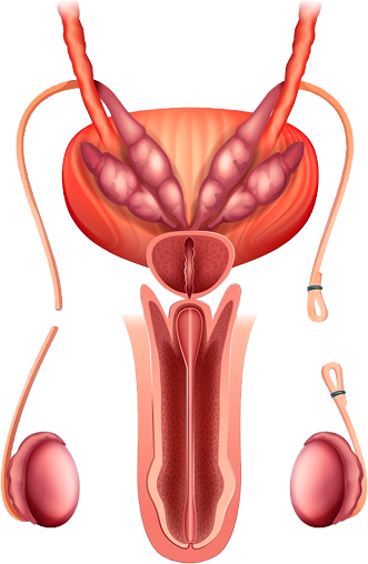 Vasectomía